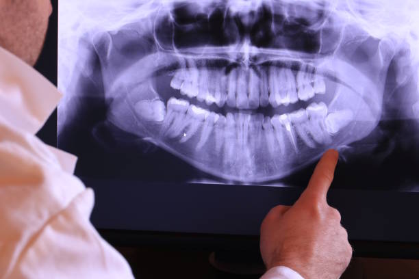 Best Orthodontic Emergency Dentist in Taft Mosswood, CA