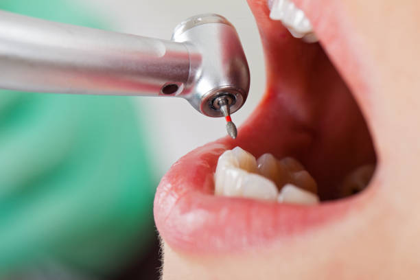 Best Emergency Dental Care for Abscessed Tooth in Taft Mosswood, CA